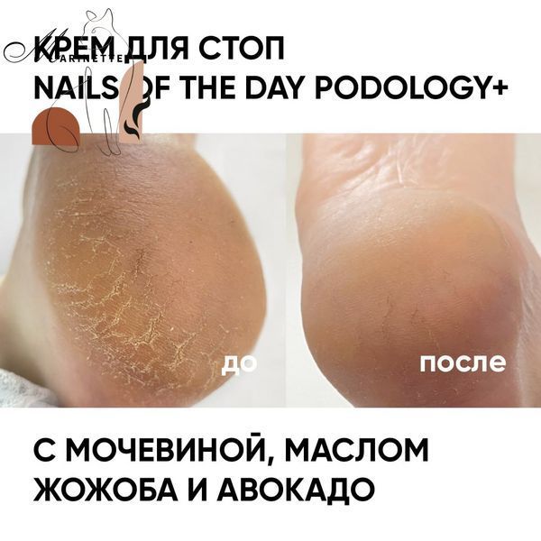 Крем для стоп Nails Of The Day Podology+ для трещин с маслом таману и жожоба 30 мл NOTD_519 фото
