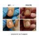 Масло для ногтей Nails Of The Day ONISTOP против онихолизиса 15 мл NOTD_82 фото 4