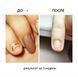 Масло для ногтей Nails Of The Day ONISTOP против онихолизиса 8 мл NOTD_084 фото 5